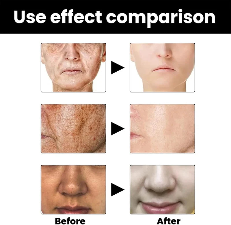 Eelhoe - Melanin Correcting Serum