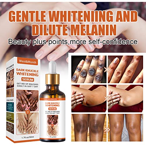 Dark Knuckle Whitening Serum 50ml - For Knuckles, Elbows, Knees & Dark Spots