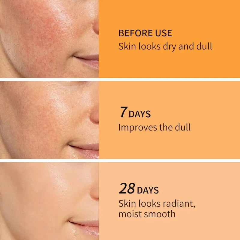 KORMESIC Retinol Night Cream 30g - 1.06 Oz - Anti-Wrinkle & Repairing Night Cream