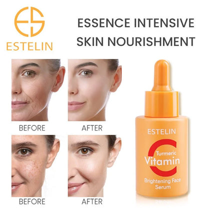 Product Title: Estelin Turmeric Vitamin C Brightening Face Serum