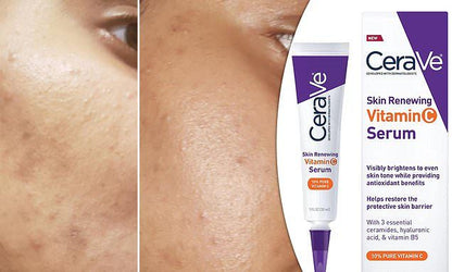 Product Title: CeraVe Skin Renewing Vitamin C Serum – 10% Pure Vitamin C
