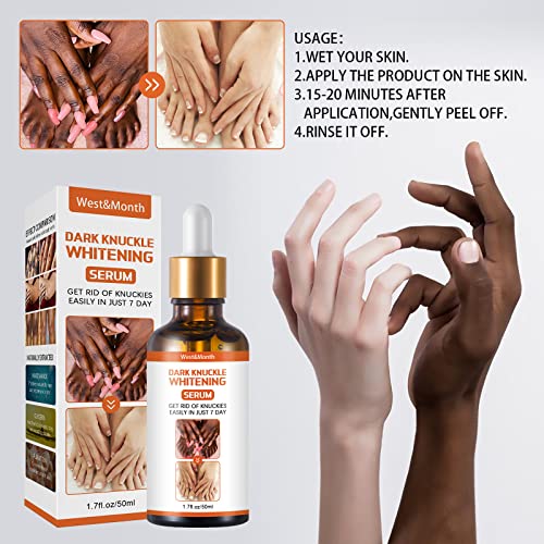 Dark Knuckle Whitening Serum 50ml - For Knuckles, Elbows, Knees & Dark Spots