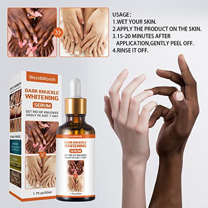 Dark Knuckle Whitening Serum 50ml - For Knuckles, Elbows, Knees & Dark Spots